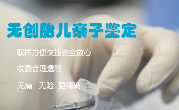 威海产前亲子鉴定条件和流程,威海产前亲子鉴定结果需要多久 威海产前亲子鉴定条件和流程,威海产前亲子鉴定结果需要多久
